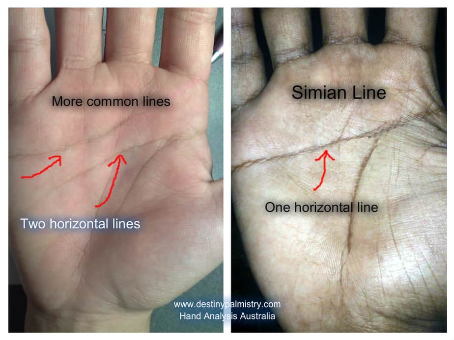 simian crease, simian line, palmistry, destiny, hand features, difficult child