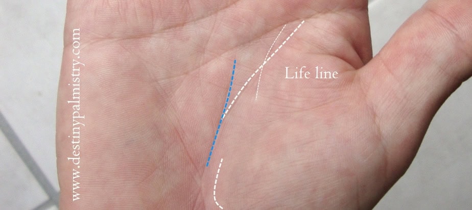 life line is broken, break in life line,