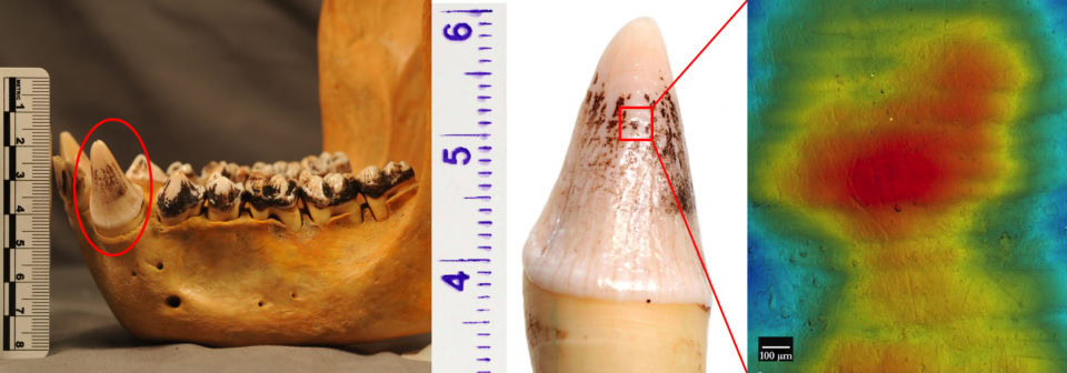 Left: Male mountain gorilla mandible. Middle: Left mandibular canine from the same individual. Right: High-resolution scan of enamel hypoplasia on the tooth surface.