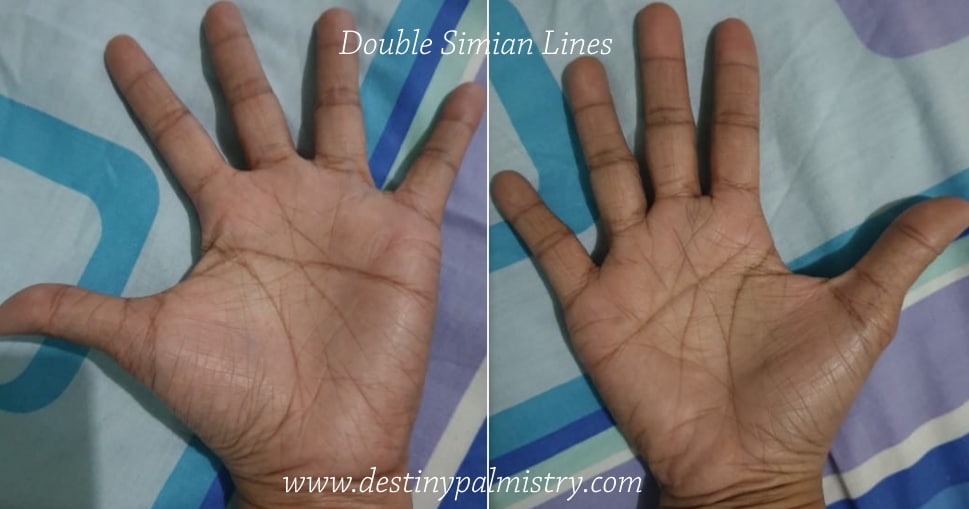 Double Simian lines on the palms