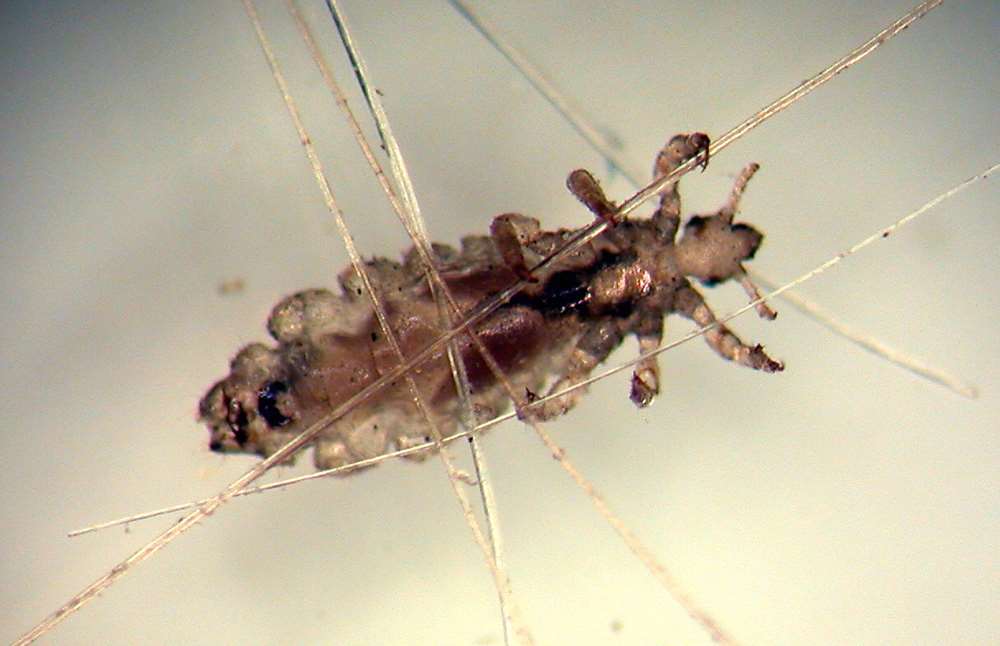 Huvudlus