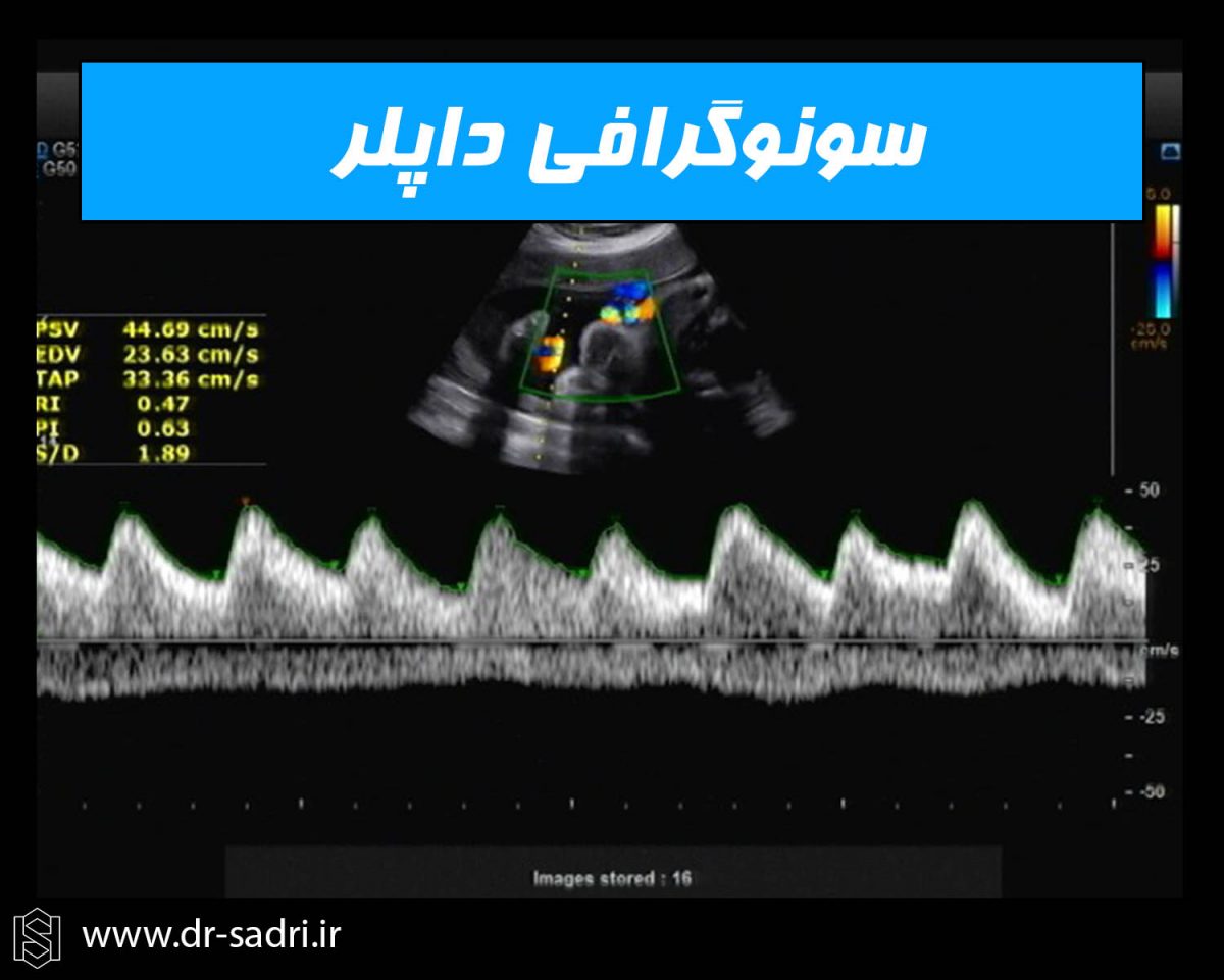 44-1200x961.jpg