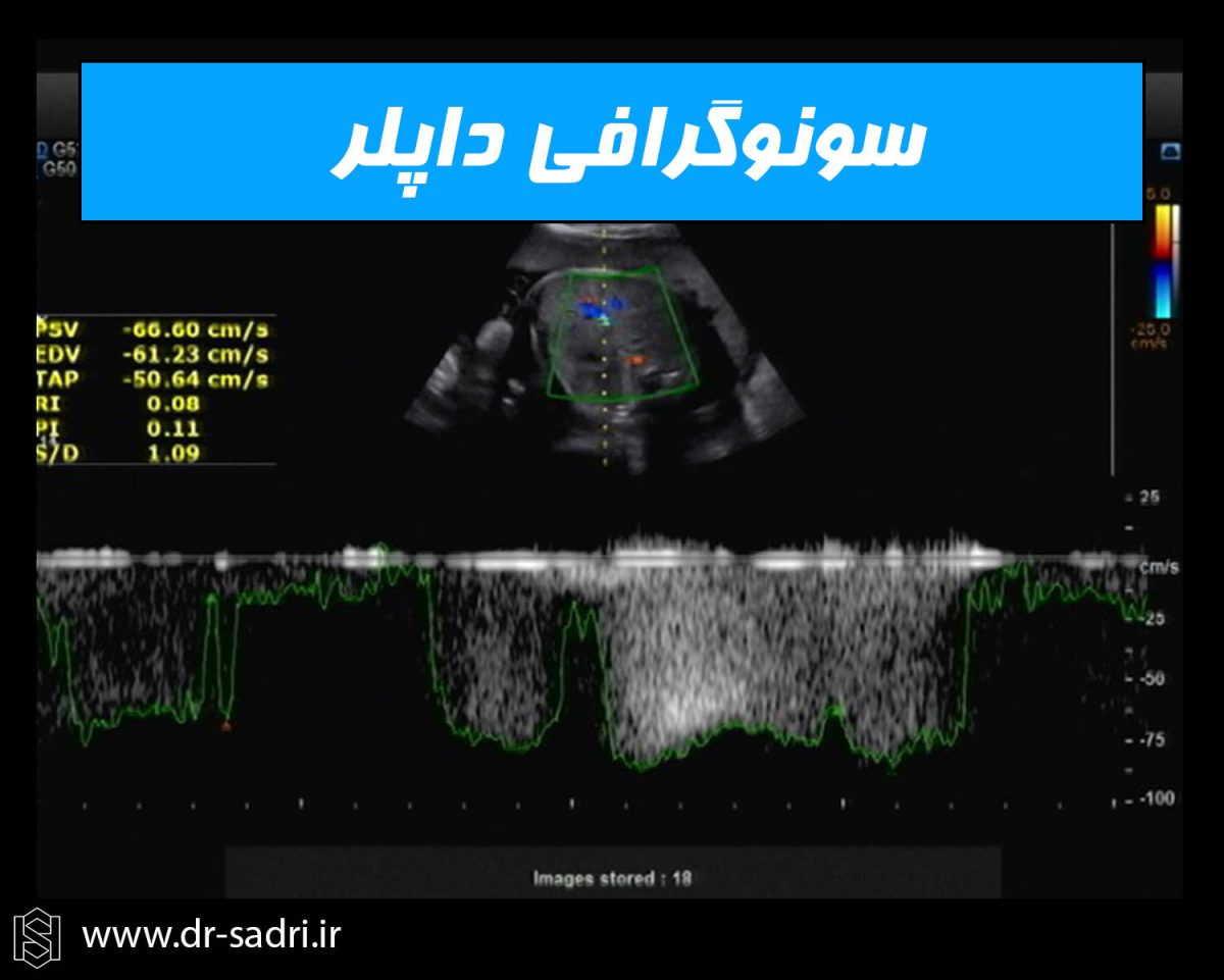 55-1200x961.jpg