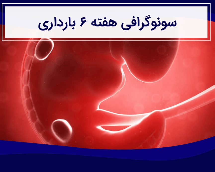 Artboard-–-127-e1588957547285.png