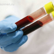 Как по крови определить пол ребенка (рассчитать…)?