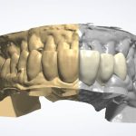 crown_design_6unit_color_change