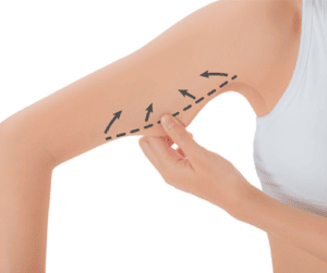 imagen brazo