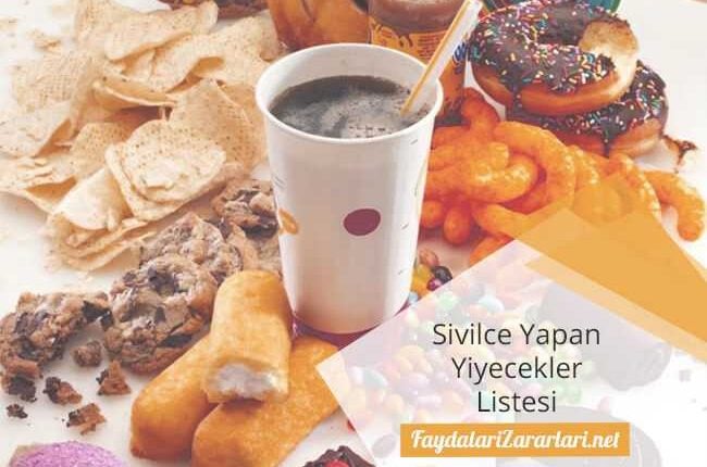 Sivilce Yapan Yiyecekler Listesi