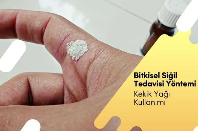 Bitkisel Siğil Tedavisi için Kekik Yağı Nasıl Kullanılır?