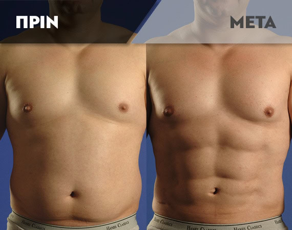 Results-Body5