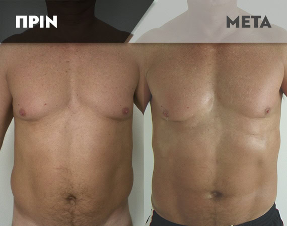 Results-Body9