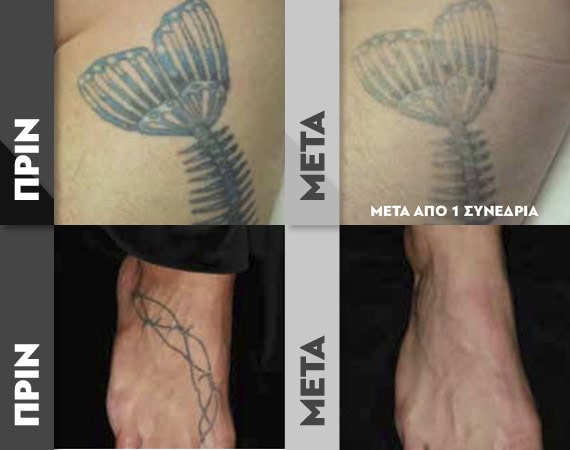 TattooR4