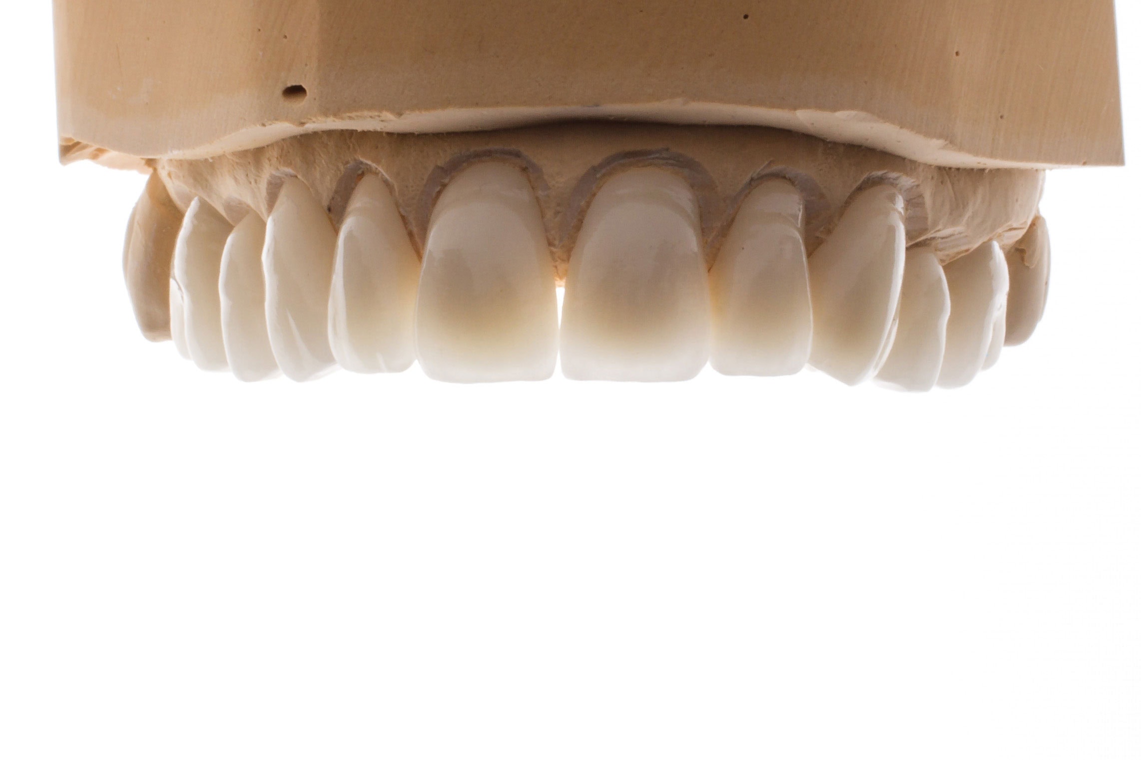 Zirconia Crown | Zirconia Dental Implants | Pindan Dental Laboratory