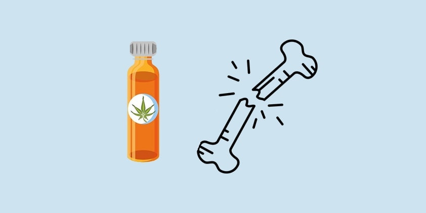 CBD as a Solution for Broken Bones, Osteoporosis and Arthritis
