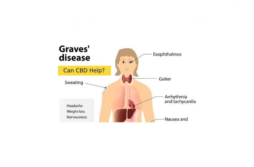 CBD for Graves Disease
