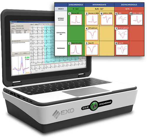 Synchromax, GPS para implantes de marcapasos, CDI y CRT Synchromax, GPS para implantes de marcapasos, CDI y CRT