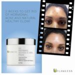 X3 Refining Glycolic Gel Pads