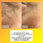 B&A X3 Face Volumizer Rod copy