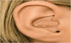 ITE-In-the-Ear2