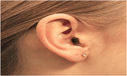 Invisible-Hearing-aid2