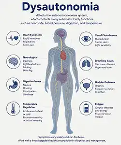 Hypnotherapy for dysautonomia