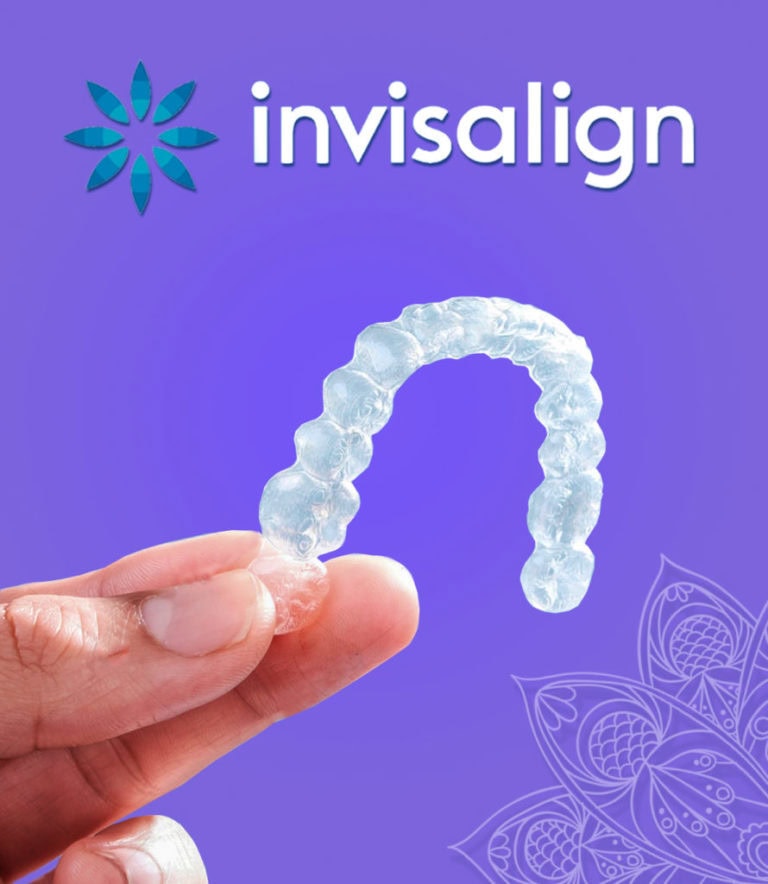 Invisalign Purple