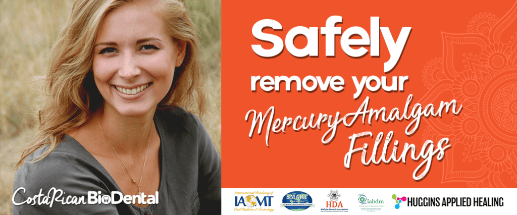 Where-should-I-remove-my-mercury-amalgam-fillings