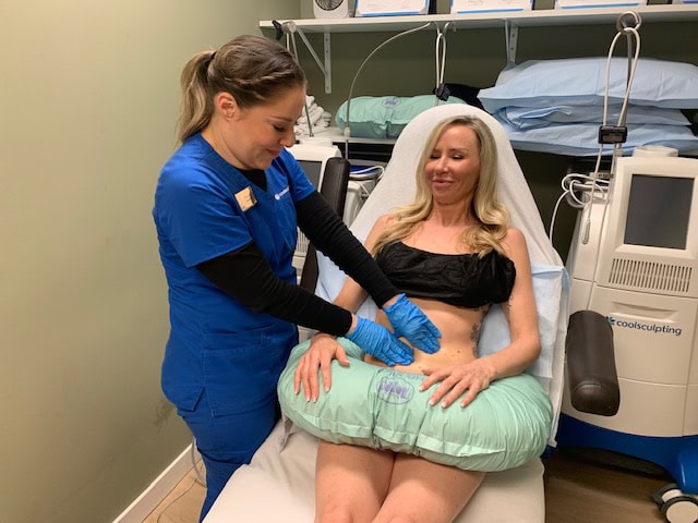 CoolSculpting With a Patient