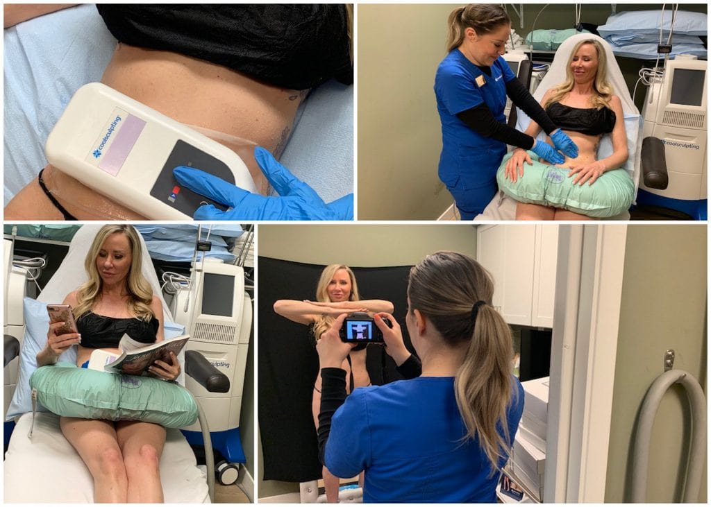 Coolsculpting Plastic Surgery MediSpa