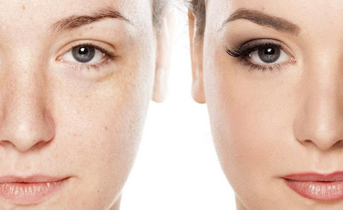 Microblading