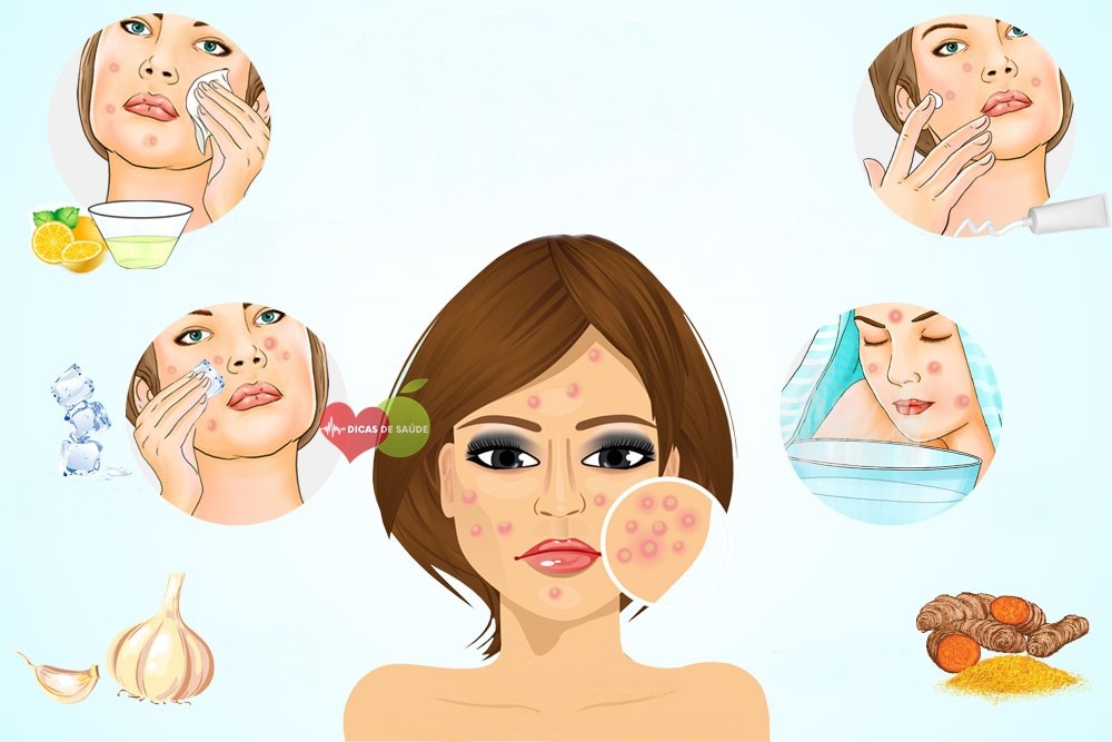 dicas caseiras para manchas | Dicas de Saúde