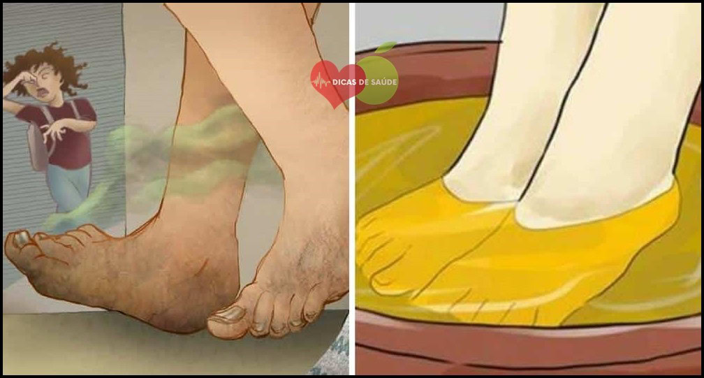Como Eliminar o Chulé em Casa em Menos de 20 Minutos | Dicas de Saúde