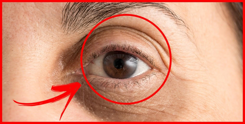 vitamina E e oleo de coco para eliminar rugas | Dicas de Saúde vitamina E e oleo de coco para eliminar rugas