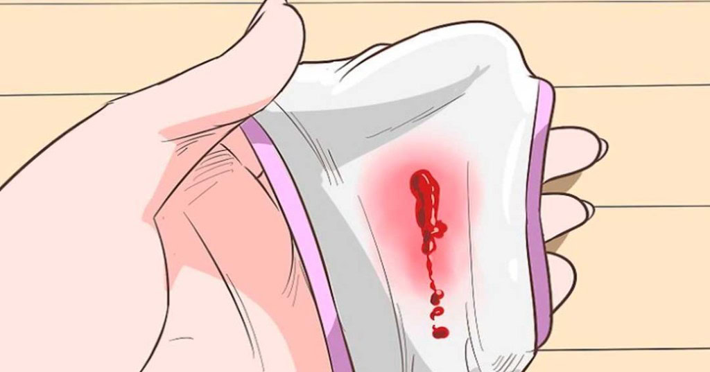 cervicite | Dicas de Saúde cervicite