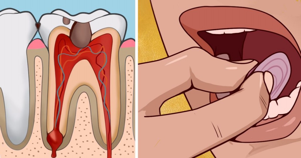remedios caseiros para dor de dente