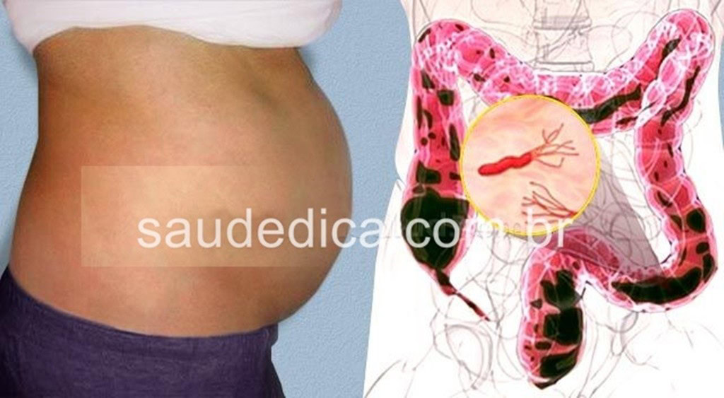 limão e pepino para eliminar barriga inchada | Dicas de Saúde limão e pepino para eliminar barriga inchada