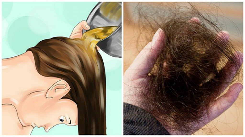 Como Combater a Queda de Cabelo Naturalmente 1 | Dicas de Saúde