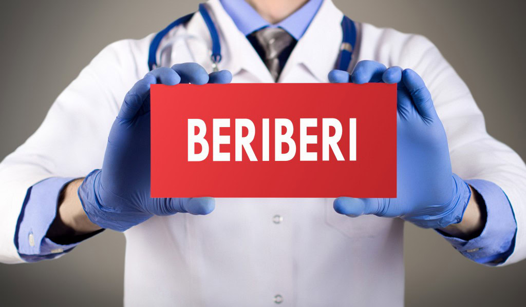 Beribéri-1 | Dicas de Saúde