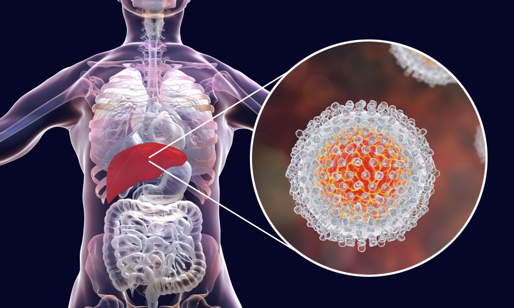 Hepatite | Dicas de Saúde Hepatite