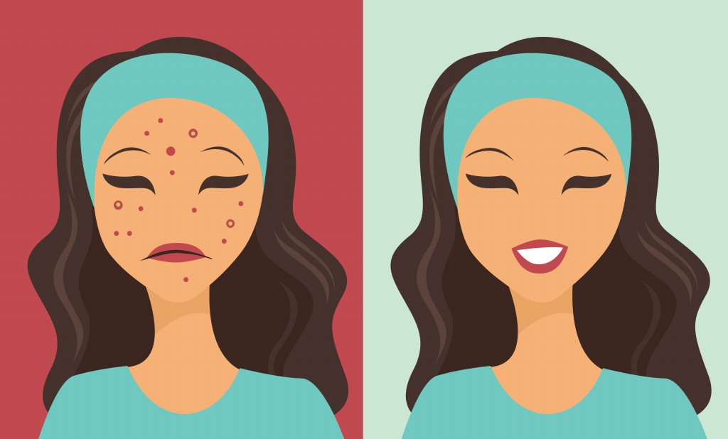 Como Usar o Óleo da Arvore do Chá Para Eliminar Acne | Dicas de Saúde