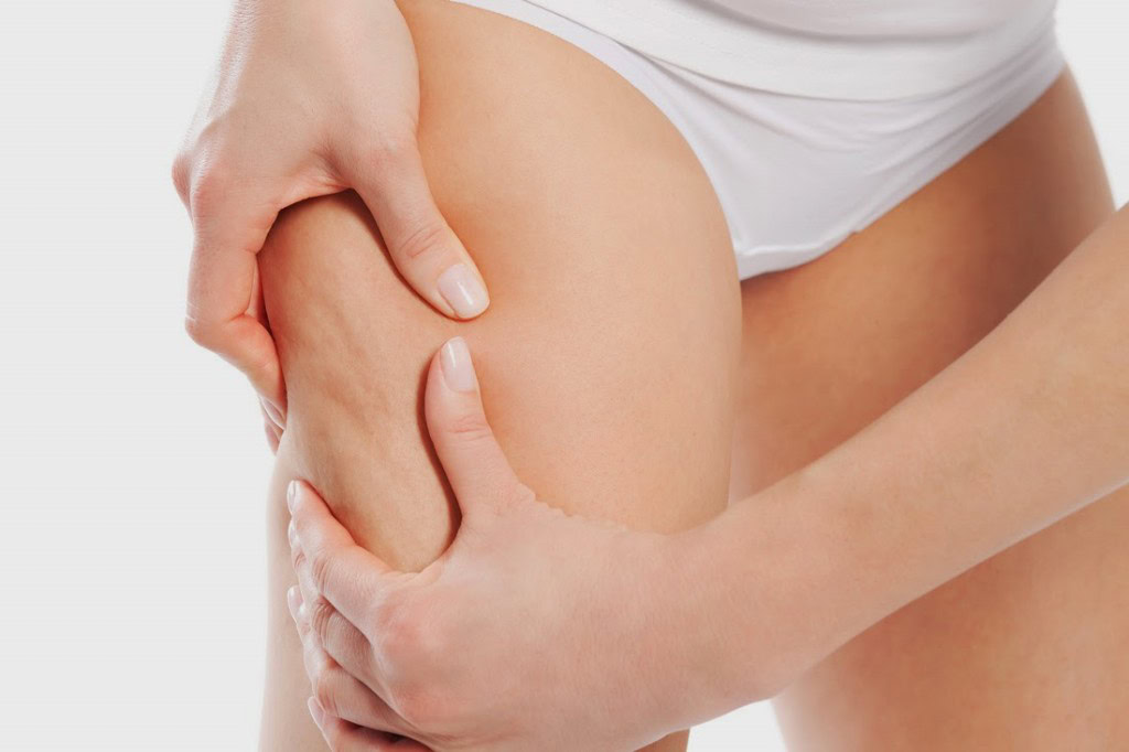 Exercícios Para Eliminar Celulite em Casa | Dicas de Saúde