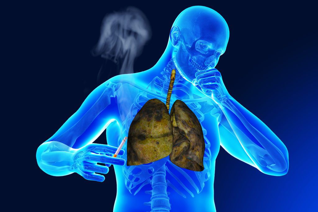 Doenças Respiratórias | Dicas de Saúde Doenças Respiratórias