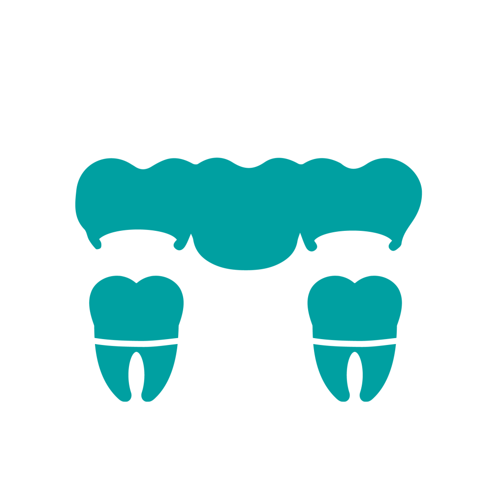 Bridge dentistry in Blacktown