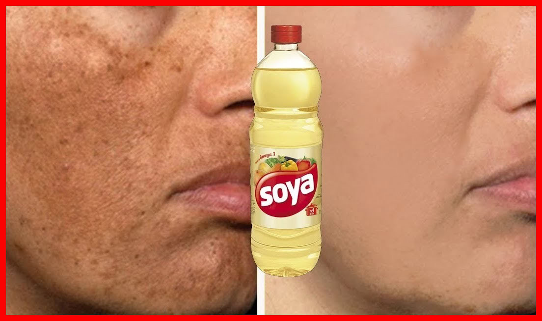 oleo caseiro para eliminar manchas e rugas | Dicas de Saúde