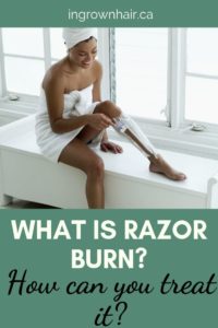 What Is The Medical Term For Razor Burn Ingrown Hair Solutions