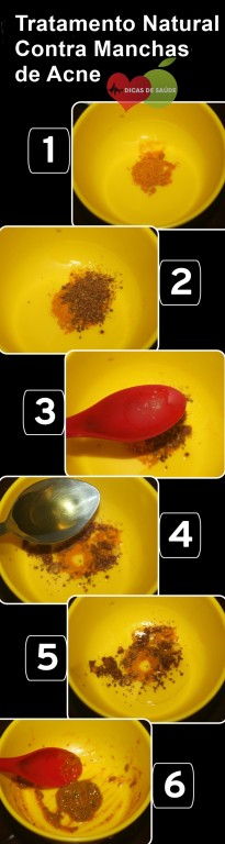 tratamento-natural-contra-acne | Dicas de Saúde