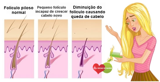 dicas-de-como-evitar-a-queda-de-cabelo | Dicas de Saúde