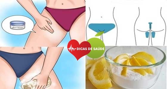 como clarear partes intimas-1 | Dicas de Saúde