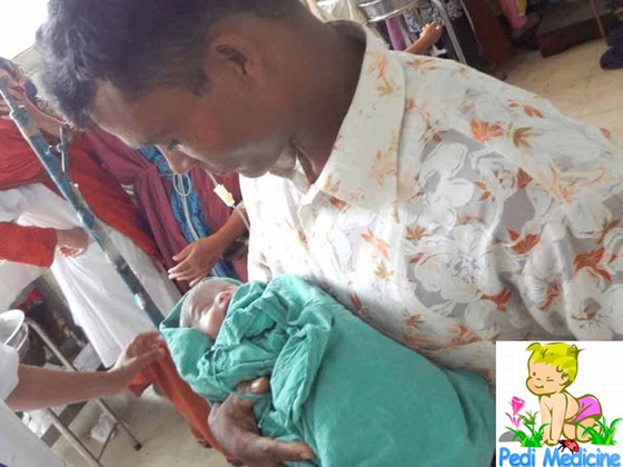 New Born Baby of Dwarf Lady with Father