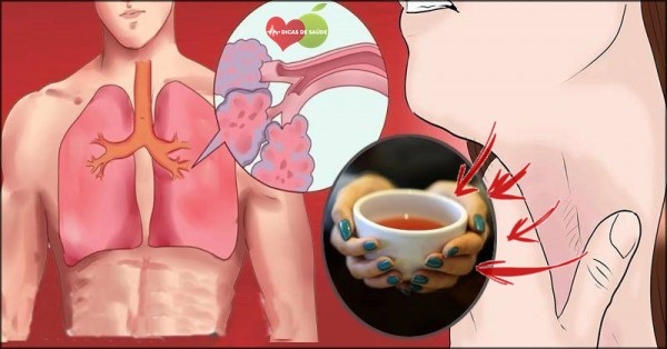 tosse seca | Dicas de Saúde tosse seca